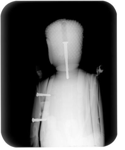 An x-ray of Bodhisattva Avalokitesvara (Guanyin) in the guise of a Buddha reveals three wood support screws. F1957.25. Courtesy of the Freer and Sackler Galleries.