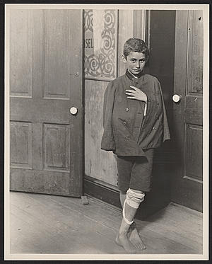 Waiting at the Clinic-Hull House Neighborhood, by Lewis Hine.